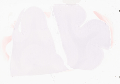 ['deident_c162301d-2b50-43f1-a249-88bc64d66a8e_69d94a0c.jpg']