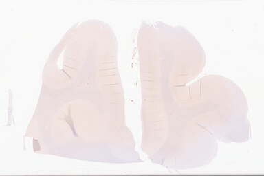 ['deident_80bba01e-01ba-4b95-b586-84aa90fb14b9_69d949f3.jpg']