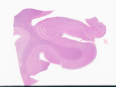 ['deident_9d6aad35-d0a4-45b5-a9dd-06954a6ee1fc_69d949fc.jpg']