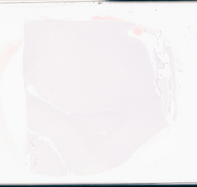 ['deident_3ace3252-3539-4cbe-b4c9-c53b43e17926_69d949ce.jpg']