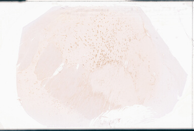 ['deident_f2f0b0c5-31c3-4a26-8d1d-81e4781003b6_69d94a2a.jpg']