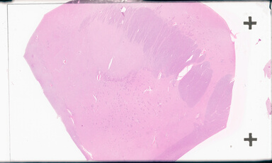 ['deident_7beeea5b-9f4f-4b97-b473-ab7ed256585f_69d949ed.jpg']