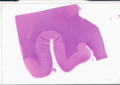 ['deident_dd259fd5-366f-4de2-a398-0270da244584_69d94a20.jpg']