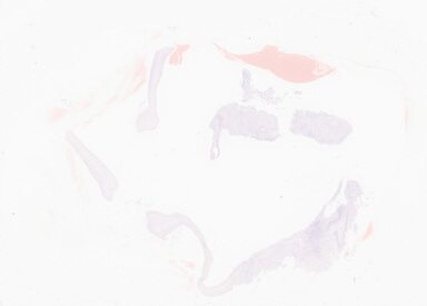 ['deident_fa5af011-33ec-40d9-b0e1-c86db90ca9ef_69d94a2e.jpg']