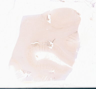 ['deident_11b2f1d0-9380-4864-859a-82c45f998dcc_69d949b3.jpg']