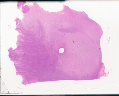 ['deident_ac0b362e-fe29-4eee-9026-5569d0f09c30_69d94a04.jpg']