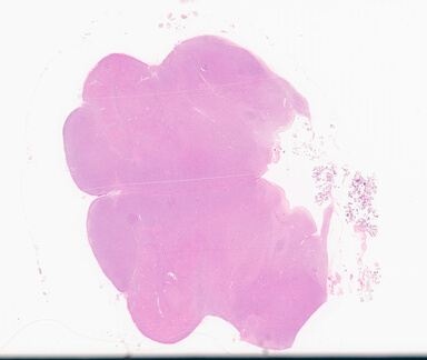 ['deident_2da4385e-d531-46bd-a681-386a47d9ab71_69d949cb.jpg']
