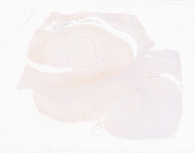 ['deident_1f3d176c-3ea9-443b-8a3b-68139eb30d42_69d949c1.jpg']