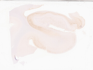 ['deident_7a3fc18f-5f2b-4003-a6dd-c35af7a0f343_69d949eb.jpg']