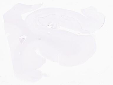 ['deident_6df33803-b60e-4433-9ff7-e18f216674de_69d949e2.jpg']