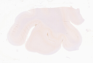 ['deident_0cbbabe5-df0e-4bbd-b225-bf8a8a712e21_69d949b2.jpg']