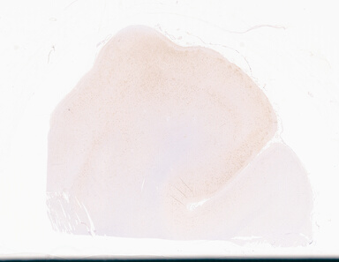 ['deident_d5cf7d83-96bc-4338-98aa-1170ae941d5c_69d94a1a.jpg']