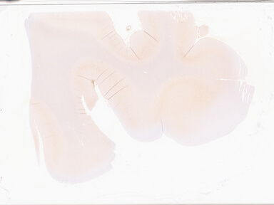 ['deident_5648a97f-c3a3-4ce1-9dec-98ce42f249b2_69d949d6.jpg']