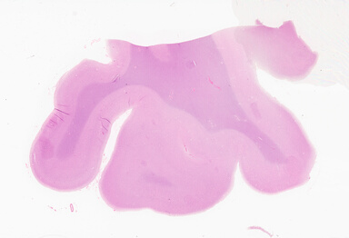 ['deident_a3332546-42c4-4800-9626-9a063d566fc6_69d949ff.jpg']