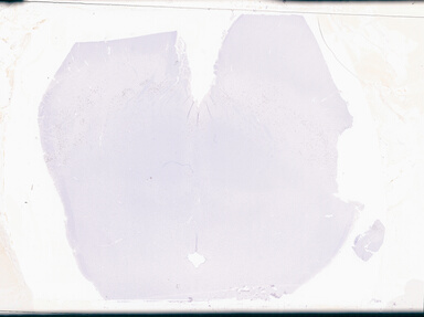 ['deident_1d94bd6a-21b0-4550-b0cc-946d56b80c1d_69d949ba.jpg']