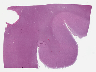 ['deident_36fb0d90-8891-4f99-9952-f545c93b5996_69b04477.jpg']