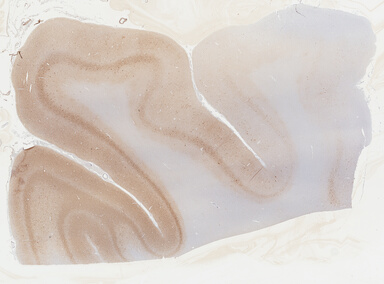 ['deident_d2c72b23-1334-4de5-a730-6b87374c52c0_69b044b1.jpg']