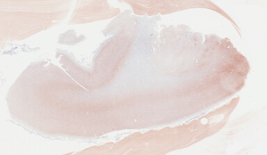 ['deident_e1e6faf0-0cd6-4486-b661-b6ce180e09fc_69b044b6.jpg']