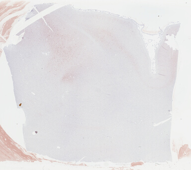 ['deident_cae56b32-ea5a-447d-ab38-1064fe84e3bd_69b044aa.jpg']