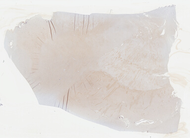 ['deident_3d21abba-6da8-441c-a62d-f329d52ccda9_69b0447e.jpg']