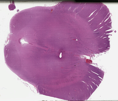 ['deident_44e1dc91-4025-41ec-89cc-575c2aa0d889_69b04482.jpg']