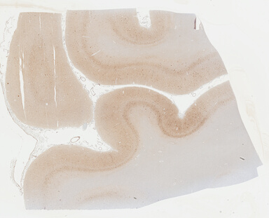 ['deident_524dc55f-c627-4fb8-9b45-4dbf6a18bde9_69b04486.jpg']