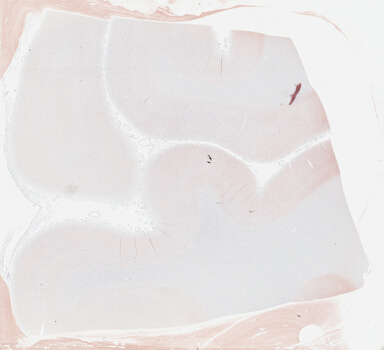 ['deident_2bf2f292-04b4-4e79-ad82-0029bd5e25b4_69b04476.jpg']