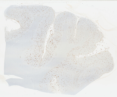 ['deident_5c195f0e-45b6-482b-a489-7628b51b26a8_69b0448b.jpg']