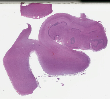 ['deident_1d6ce90d-9d8e-4802-91c2-10a6c510d01f_69b0446c.jpg']
