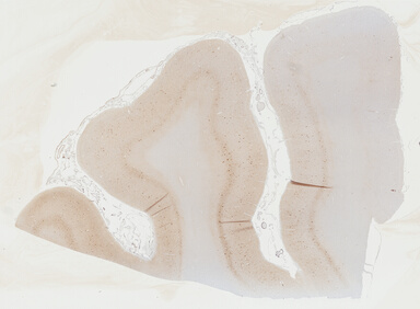 ['deident_5eed6926-1cf3-44be-a110-c5c16aaec29c_69b0448e.jpg']
