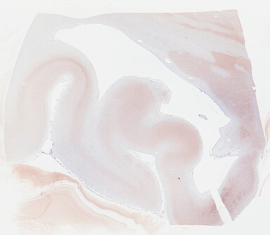 ['deident_0db3ece9-8931-439b-99a7-bb2d4983c23d_69b04465.jpg']