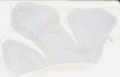 ['deident_9dd14175-4b83-432f-a3c5-a9e4005c3698_69b0449a.jpg']