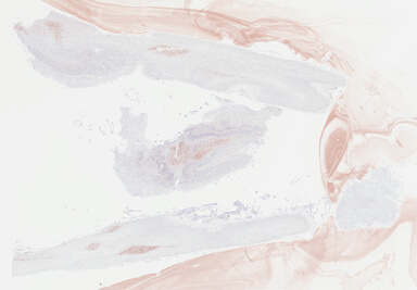 ['deident_83ea4bf9-c946-430a-8678-a3fc0604096c_69b04495.jpg']