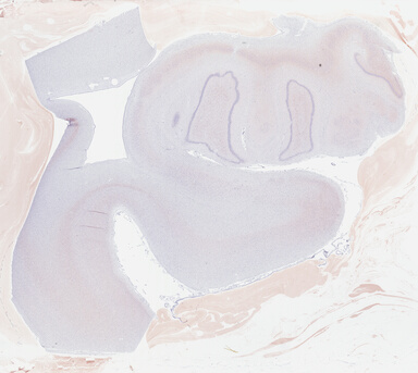 ['deident_1a6ca4d3-48a8-44ae-ac8d-bd5436d4856b_69b0446a.jpg']
