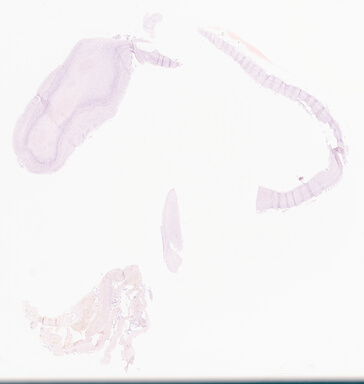 ['deident_728144f6-99a7-459a-929d-344938f2878a_69d9585c.jpg']