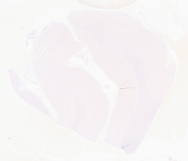 ['deident_472eafa7-ea93-44ca-973f-0ab65d3a189b_69d9584e.jpg']