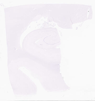 ['deident_03bd7aae-d387-4dc0-92bf-253a21677f30_69d9581d.jpg']