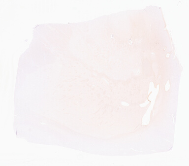 ['deident_41daab2d-d484-4a17-8663-e4dc76dbf4c6_69d9584a.jpg']