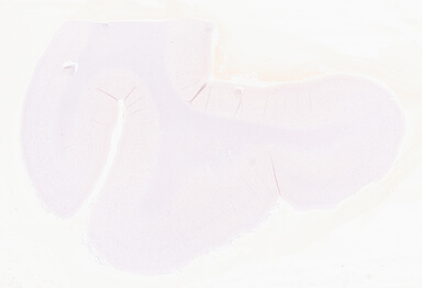 ['deident_7fdfa029-2d00-4d52-8733-1f173ee33e13_69d95861.jpg']