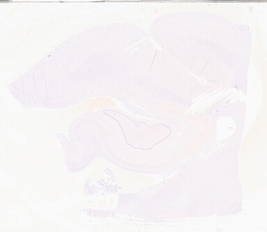 ['deident_c769bff2-56a5-4087-a938-caffe99461a9_69d95883.jpg']