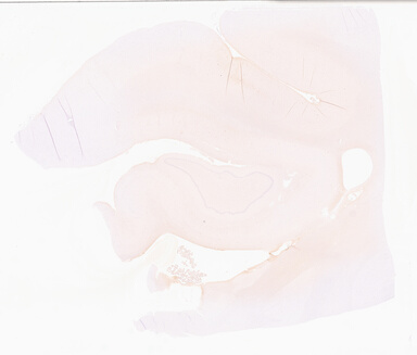 ['deident_727171ac-468b-4306-bf69-ded132f10176_69d9585a.jpg']