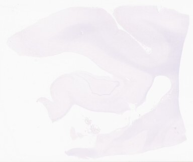 ['deident_e631a1e0-9fbd-4ca2-a8f4-8a739e8b4214_69d9588f.jpg']