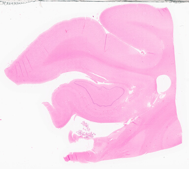 ['deident_4c90667c-1497-4249-a02f-2b29a78f6be7_69d95850.jpg']
