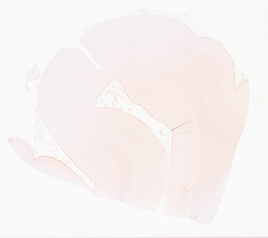 ['deident_99ff039b-feb1-4556-bb73-f68ba2b238c6_69d9586e.jpg']