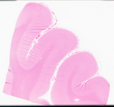 ['deident_966e32a3-ef35-47f6-8cce-f714b61a5473_69d9586c.jpg']