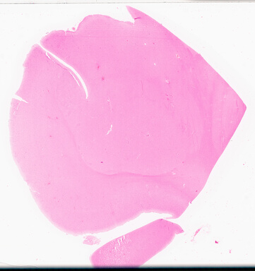 ['deident_24ac80f0-50fd-4bbe-879d-b38b67a0ec57_69d95832.jpg']