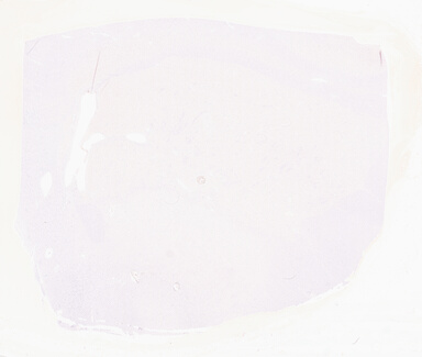 ['deident_2c9ed150-9047-45dc-961e-203c78c74991_69d95838.jpg']