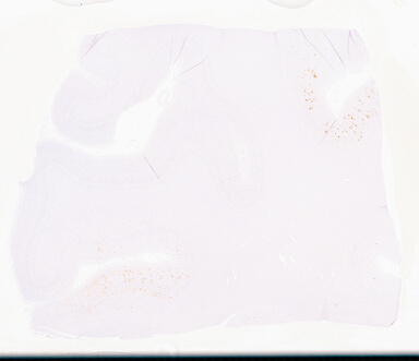['deident_8eb6acd0-a1d1-45fb-903a-2252c6249a97_69d9586a.jpg']