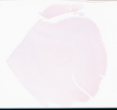['deident_d9944410-c562-4eff-9432-6d73d95d6351_69d95889.jpg']