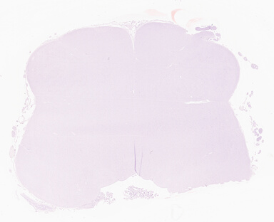 ['deident_abecae24-7b8e-429e-a868-cc4a18a479ab_69d95872.jpg']